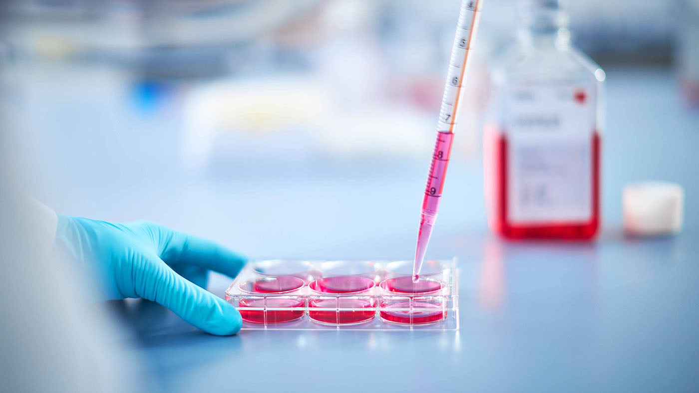 Could HLA-type be the answer to individual differences in COVID-19 severity?